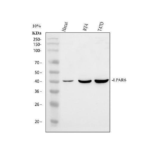 Anti-P2RY5/LPAR6 Antibody Picoband® Boster Bio
