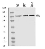 Anti-PPFIA1 Antibody Picoband® Boster Bio