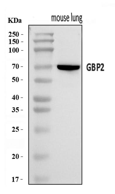 Anti-Gbp2 Antibody Picoband® Boster Bio