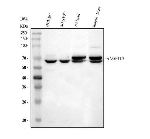 Anti-ANGPTL2 Antibody Picoband® Boster Bio