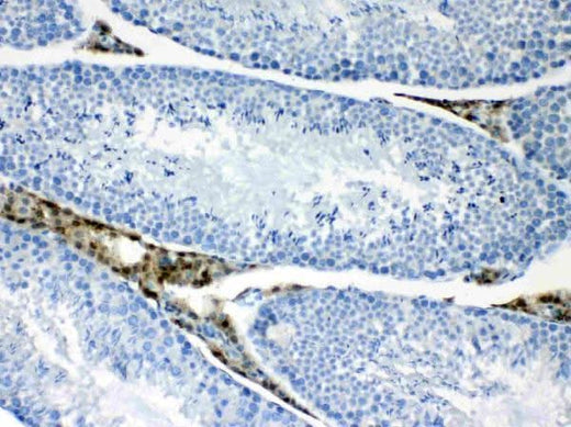 Anti-CPI17 alpha/PPP1R14A Antibody Picoband® Boster Bio
