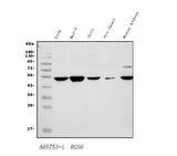 Anti-RGS6 Antibody Picoband® Boster Bio
