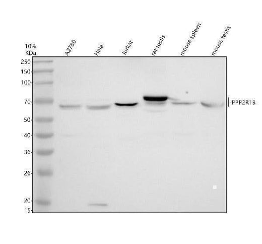 Anti-PPP2R1B Antibody Picoband® Boster Bio