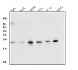 Anti-Rab9/RAB9A Antibody Picoband® Boster Bio