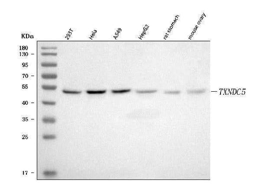 Anti-TXNDC5 Antibody Picoband® Boster Bio