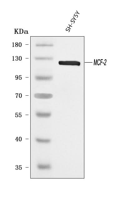 Anti-DBL Antibody Picoband® Boster Bio