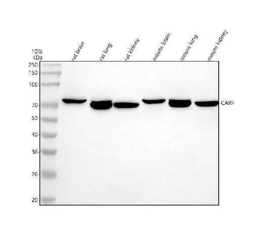 Anti-CDKN2AIP/CARF Antibody Picoband® Boster Bio