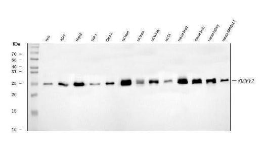 Anti-NDUFV2 Antibody Picoband® Boster Bio
