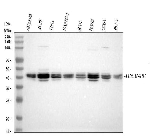 Anti-HnRNP F/HNRNPF Antibody Picoband® Boster Bio