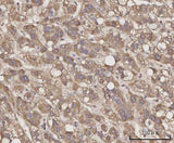 Anti-CCL23 Antibody Boster Bio