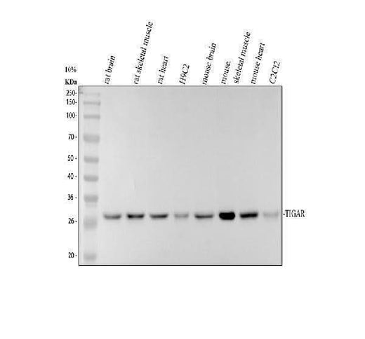 Anti-TIGAR Antibody Picoband® Boster Bio