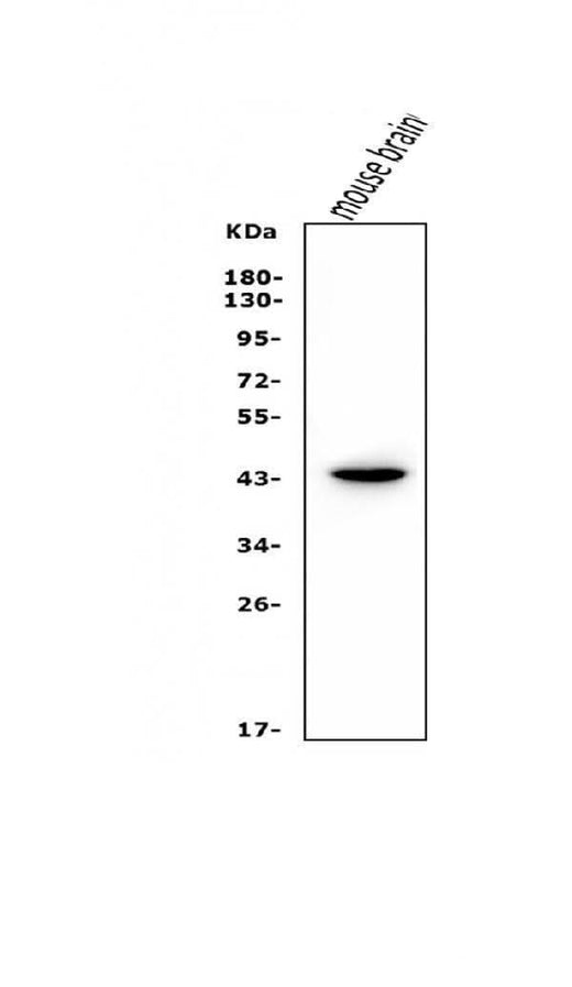 Anti-LIM1/LHX1 Antibody Picoband® Boster Bio