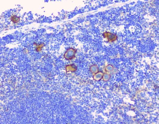 Anti-CD229/LY9 Antibody Boster Bio