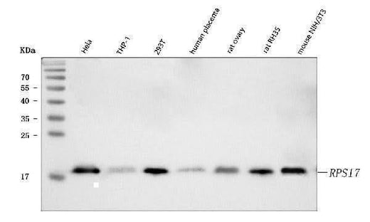 Anti-RPS17 Antibody Picoband® Boster Bio