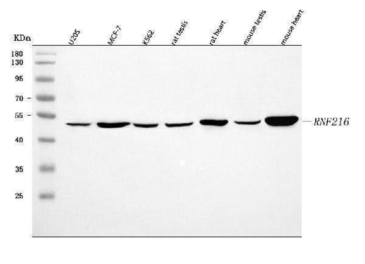 Anti-RNF216 Antibody Picoband® Boster Bio