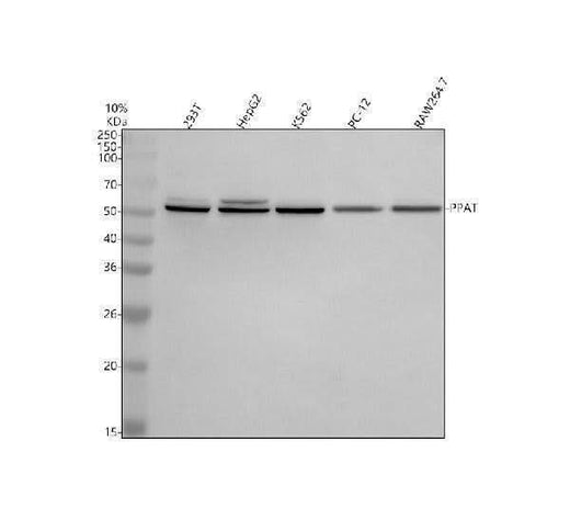 Anti-PPAT Antibody Picoband® Boster Bio