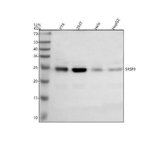 Anti-SRSF9 Antibody Picoband® Boster Bio