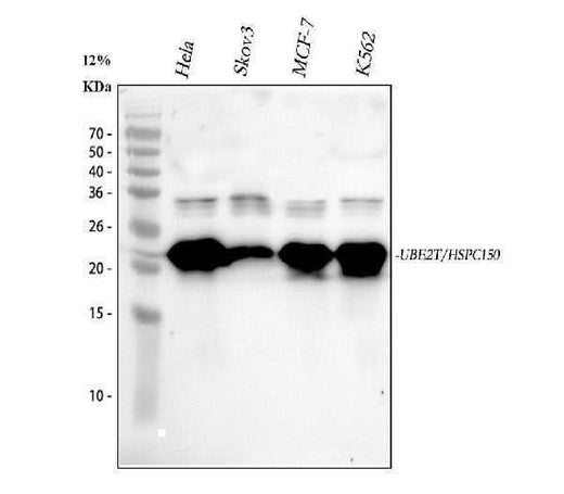 Anti-HSPC150/UBE2T Antibody Picoband® Boster Bio