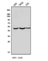 Anti-NDP52/CALCOCO2 Antibody Picoband® Boster Bio