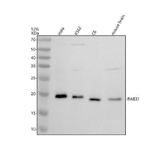 Anti-RAB31 Antibody Picoband® Boster Bio