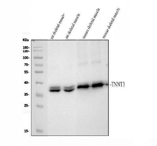 Anti-TNNT3 Antibody Picoband® Boster Bio