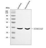Anti-ST8SIA2 Antibody Picoband® Boster Bio