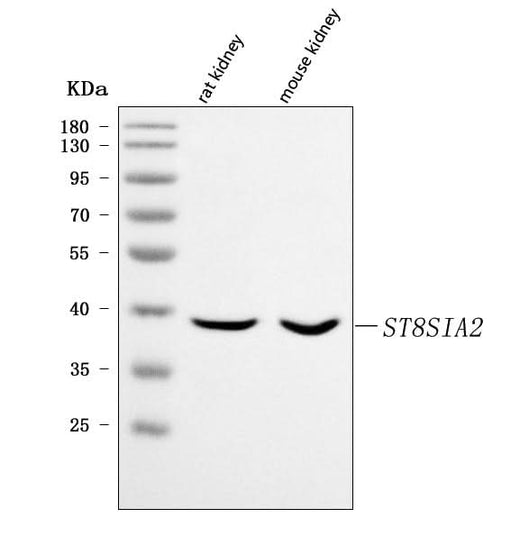 Anti-ST8SIA2 Antibody Picoband® Boster Bio