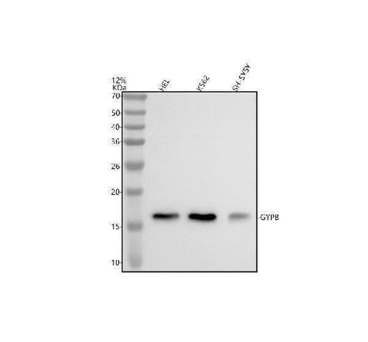 Anti-GYPB Antibody Picoband® Boster Bio