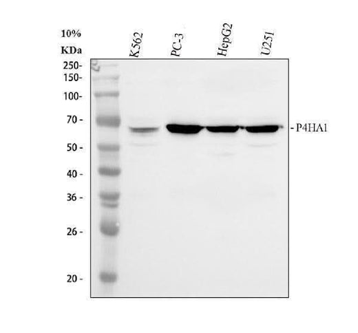 Anti-P4HA1 Antibody Picoband® Boster Bio
