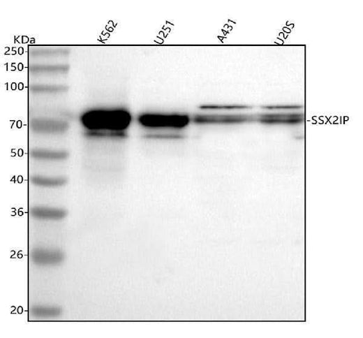 Anti-SSX2IP Antibody Picoband® Boster Bio