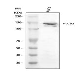 Anti-PLCB2 Antibody Picoband® Boster Bio