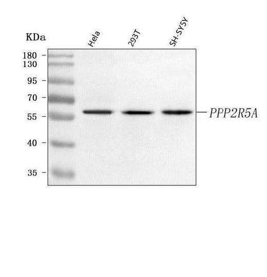Anti-PPP2R5A Antibody Picoband® Boster Bio