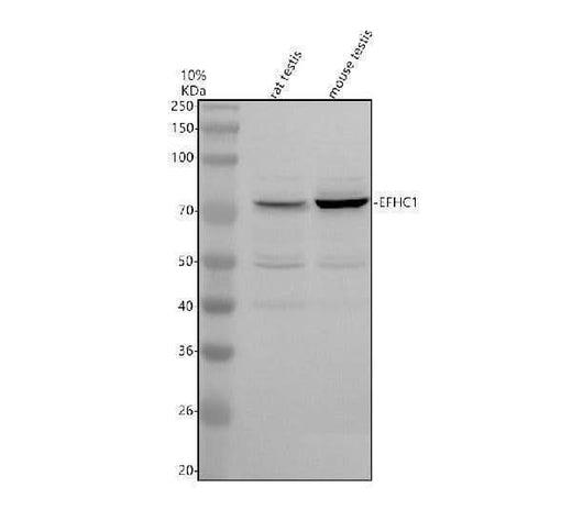 Anti-TIMM44 Antibody Picoband® Boster Bio