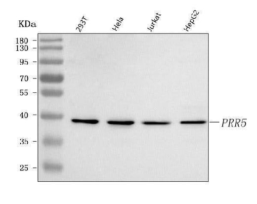 Anti-PRR5 Antibody Picoband® Boster Bio