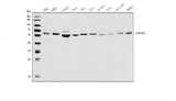 Anti-PFKFB2 Antibody Picoband® Boster Bio