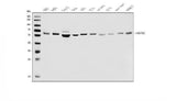 Anti-PFKFB2 Antibody Picoband® Boster Bio