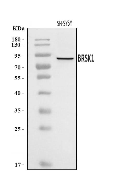 Anti-BRSK1 Antibody Picoband® Boster Bio