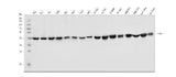 Anti-FABP-1/GOT2 Antibody Picoband® Boster Bio