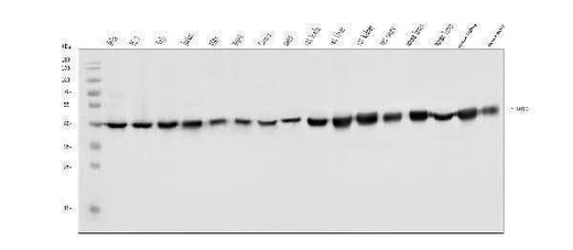 Anti-FABP-1/GOT2 Antibody Picoband® Boster Bio