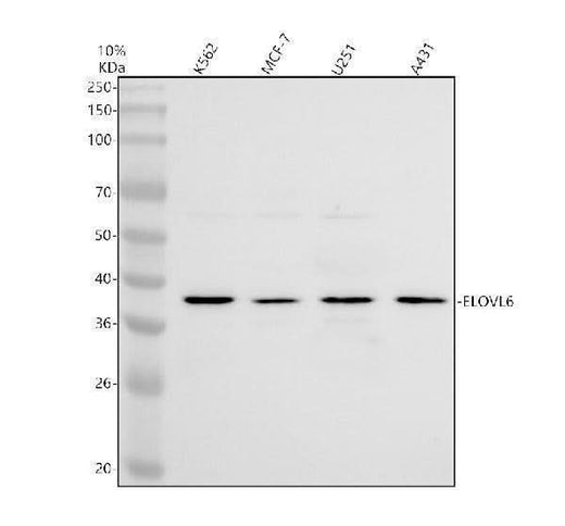 Anti-ELOVL6 Antibody Picoband® Boster Bio