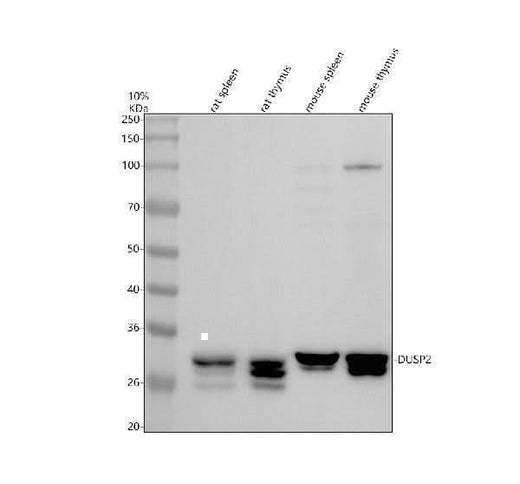 Anti-DUSP2 Antibody Picoband® Boster Bio