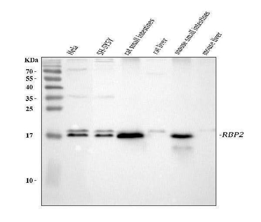 Anti-RBP2 Antibody Picoband® Boster Bio