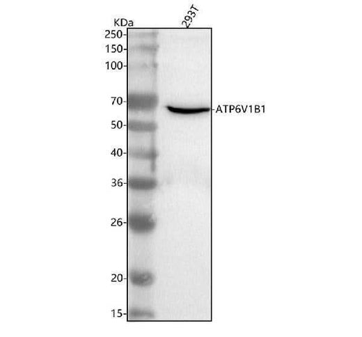 Anti-ATP6V1B1 Antibody Picoband® Boster Bio
