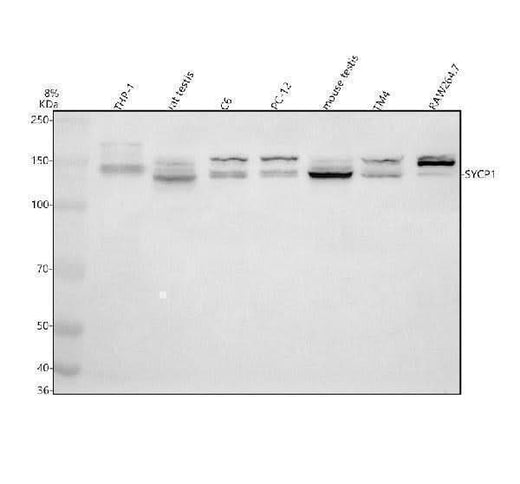 Anti-SYCP1 Antibody Picoband® Boster Bio