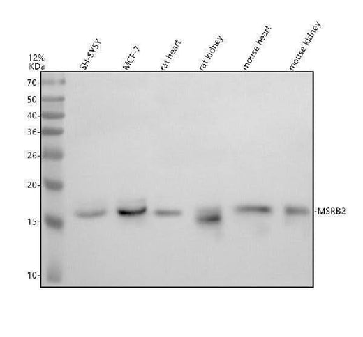 Anti-MSRB2 Antibody Picoband® Boster Bio
