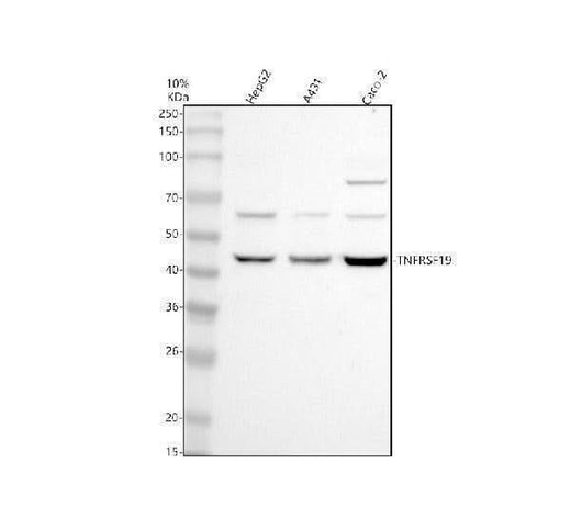 Anti-TNFRSF19 Antibody Picoband® Boster Bio