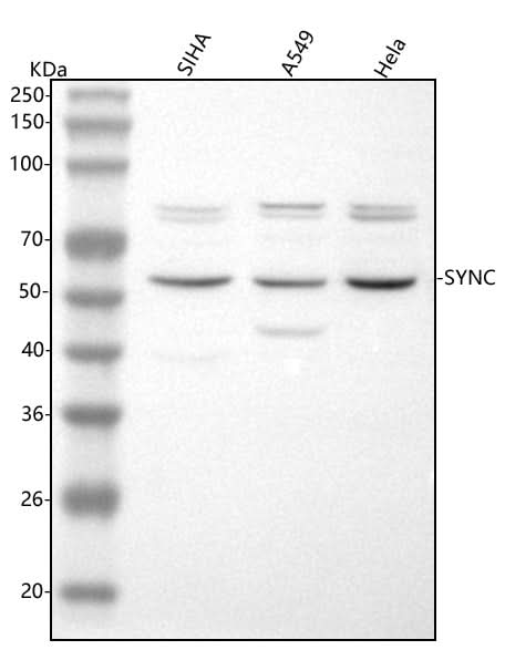 Anti-Syncoilin/SYNC Antibody Picoband® Boster Bio