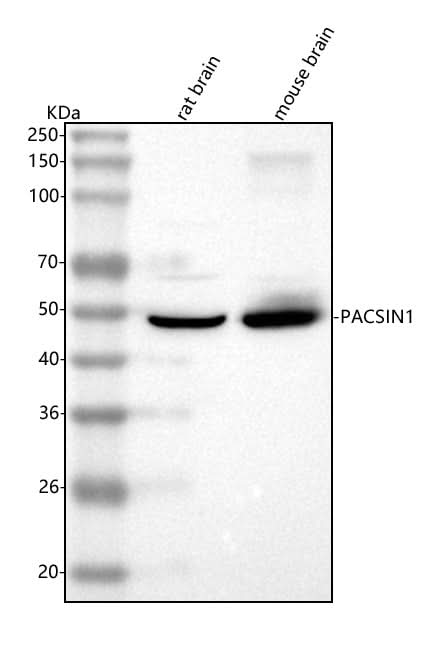 Anti-PACSIN1 Antibody Picoband® Boster Bio