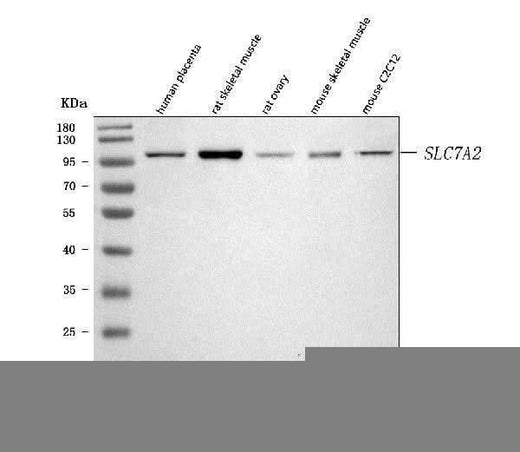 Anti-CAT2/SLC7A2 Antibody Picoband® Boster Bio