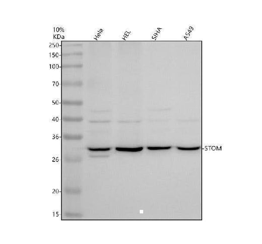Anti-Stomatin/STOM Antibody Picoband® Boster Bio